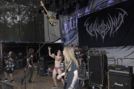 VULVODYNIA